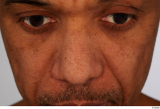 Tiago nose 0001.jpg